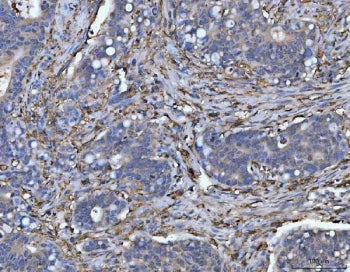 HLA-DRA Antibody / HLA-DR