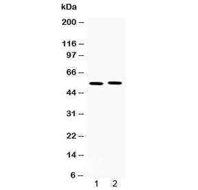 Western blot testing of 1) rat spleen and 2) human MM231 lysate with MMP11 antibody at 0.5ug/ml. Pre