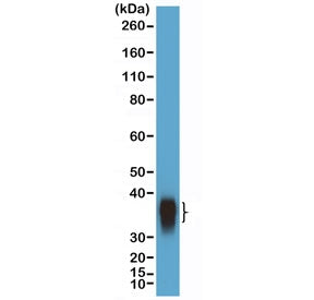 Recombinant BOB-1 Antibody / POU2AF1