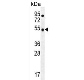 TBC1D13 Antibody
