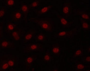 PRP19 Antibody / NMP200 / SNEV