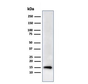Western blot testing of human HeLa cell lysate using recombinant FABP5 antibody (clone rFABP5/6354).