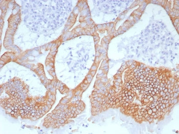 Cytokeratin 20 Antibody