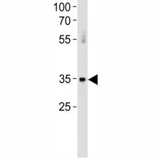 ATF7 antibody western blot analysis in huamn placenta tissue lysate. Predicted molecular weight: iso