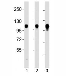 Western blot testing of Integrin alpha 7 antibody at 1:2000 dilution. Lane 1: HeLa lysate; 2: Jurkat
