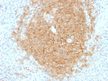 CD40 Antibody