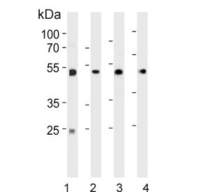 Alpha Enolase Antibody / ENOA