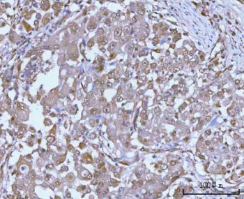 PSMC4 Antibody / 26S proteasome regulatory subunit 6B / TBP-7