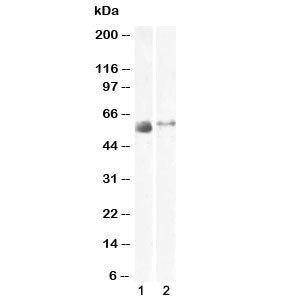 Western blot testing of human 1) lung and 2) skeletal muscle lysate with SLC7A7 antibody at 2ug/ml.