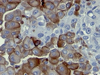 NGF Receptor Antibody / p75NTR / CD271