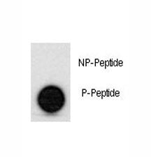 Phospho-p53 Antibody (pS315)