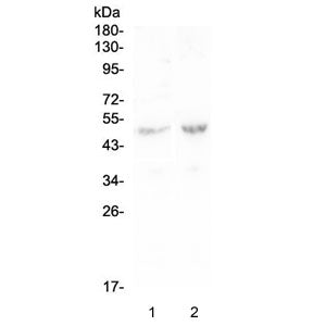 PLA2G7 Antibody / Lp-PLA2 / PAFAH