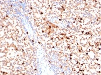 MPO Antibody / Myeloperoxidase
