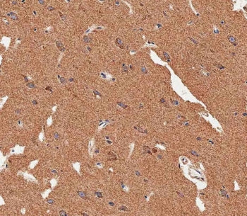 LC3B Antibody / MAP1LC3B