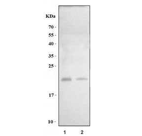 Camp Antibody