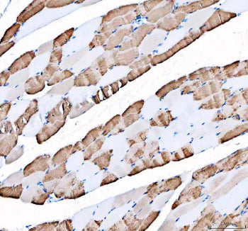 Immunohistochemical staining of FFPE human skeletal muscle tissue with ATP2A1 antibody, HRP-secondary and DAB substrate. HIER: boil tissue sections in pH8 EDTA for 20 min and allow to cool before testing.