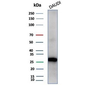 Western blot testing of human Daudi cell lysate with Haptoglobin antibody (clone HP/4813). Predicted
