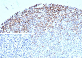 CD35 Antibody / CR1