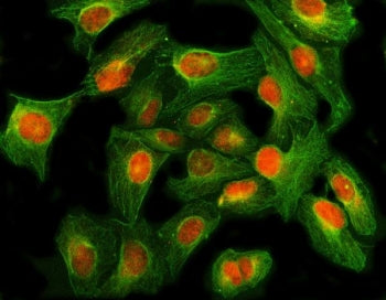 Immunofluorescent staining of FFPE human U-2 OS cells with GLI2 antibody (red) and Beta Tubulin mAb