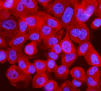 Interferon regulatory factor 3 Antibody / IRF3