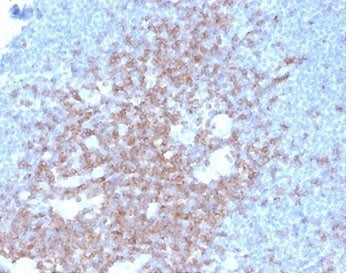 CD2 Antibody
