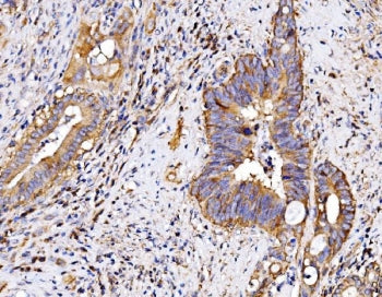 P2RX7 Antibody / P2X7