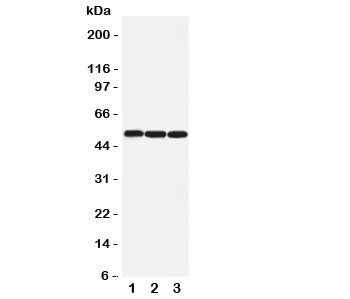 Western blot testing of beta Arrestin 1 antibody and Lane 1: rat lung; 2: rat skeletal muscle; 3: hu