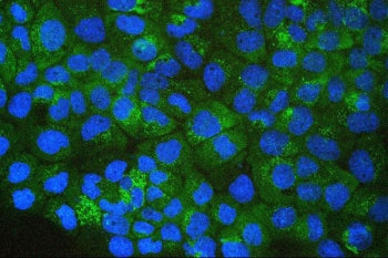 p62 Antibody / SQSTM1