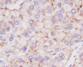 LAMP2 Antibody / CD107b (LAMP-2A isoform)