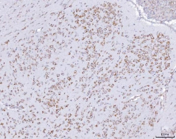 IHC staining of FFPE mouse brain tissue with PACT antibody. HIER: boil tissue sections in pH8 EDTA f