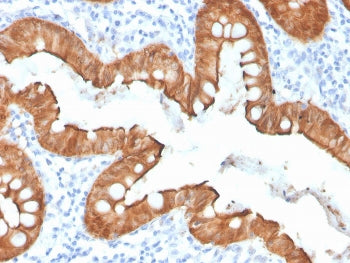 IHC staining of FFPE human colon with recombinant Villin antibody (clone VIL1/4107R). HIER: boil tis