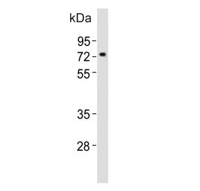 Nurr1 Antibody / Nr4a2
