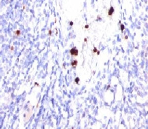 CSF3 Antibody / Granulocyte-Colony Stimulating Factor