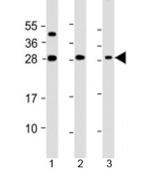 Western blot testing of 1) mouse brain, 2) mouse kidney and 3) human ThP-1 cell lysate with TPD52 an