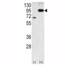 Amyloid beta Precusor Protein Antibody (APP)
