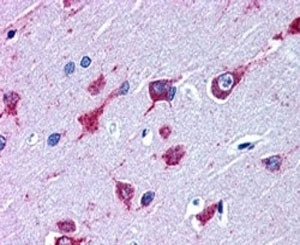 ALS2 Antibody