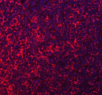 Acyl-CoA dehydrogenase family member 9 Antibody / ACAD9