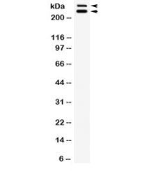 Western blot testing of rat testis lysate with WNK1 antibody. Expected molecular weight: 206-300 kDa
