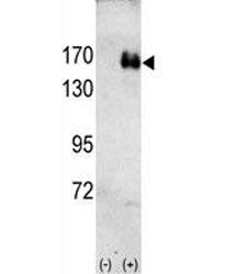 HER2 Antibody (ERBB2, NEU)