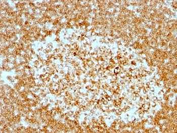 CD74 / CLIP Antibody Cocktail