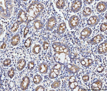 ECSIT Antibody