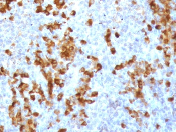 Kappa Light Chain Antibody