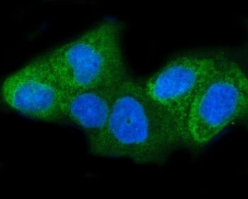 INSIG1 Antibody / Insulin-induced gene 1