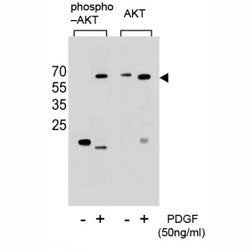 Phospho-AKT Antibody (pS473)