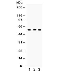 Western blot testing of 1) rat kidney, 2) mouse kidney and 3) 293 lysate with CYP27B1 antibody. Pred