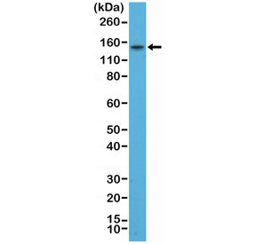 Thyroid Peroxidase Antibody / TPO