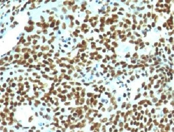Nuclear Antigen Antibody