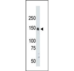 Western blot testing of mouse liver tissue lysate with CrkRS antibody. Predicted molecular weight ~1
