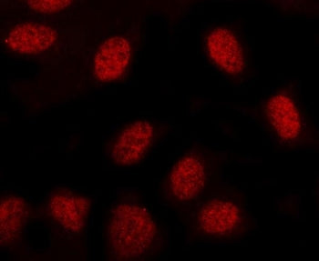 MINDY3 Antibody / CARP / DERP5