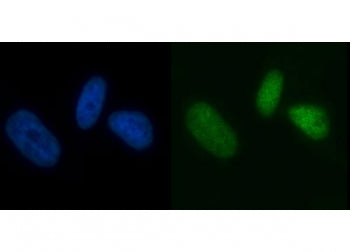 MCM7 Antibody